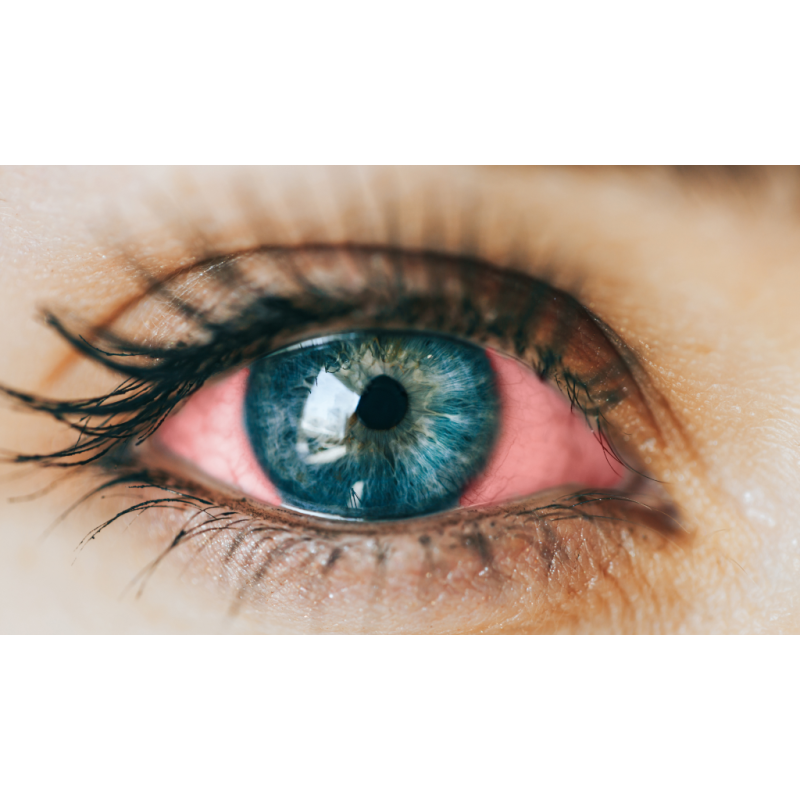 Irritación ocular Eye Irritation Test